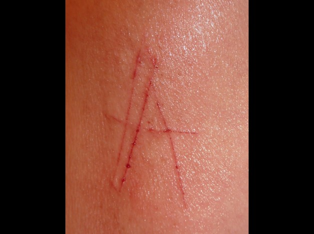 scarification 004