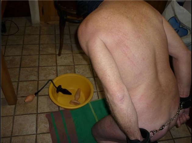 ALF apres dilate