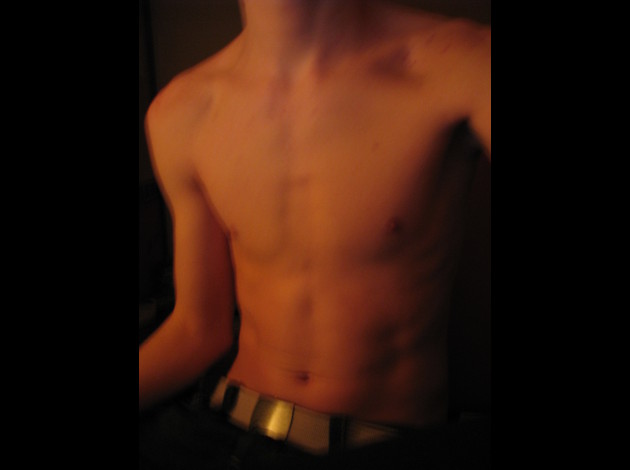 Torse nu