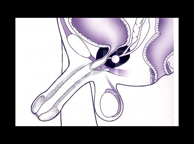 Anatomie   11 