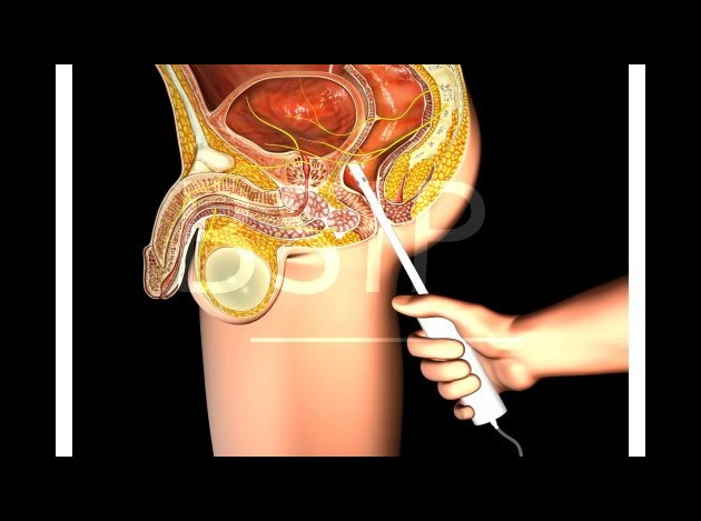 Anatomie   5 