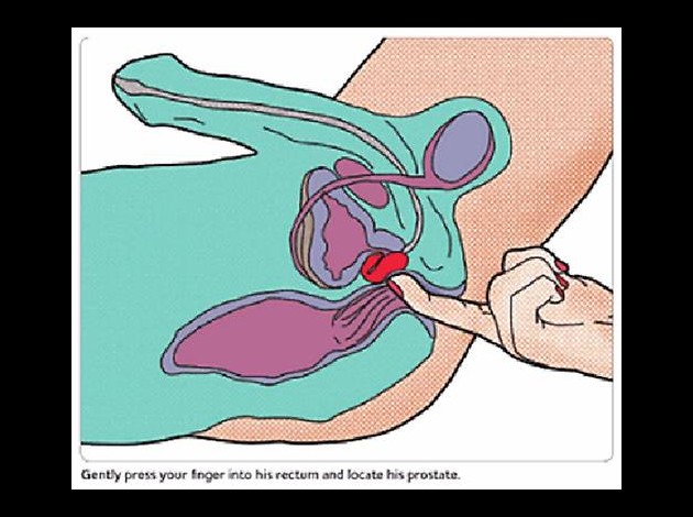 stimulation prostate etape 5jpg