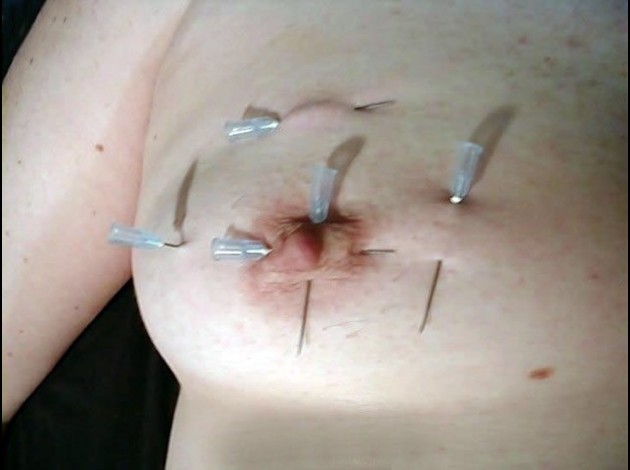 Aiguilles dans les seins (141)