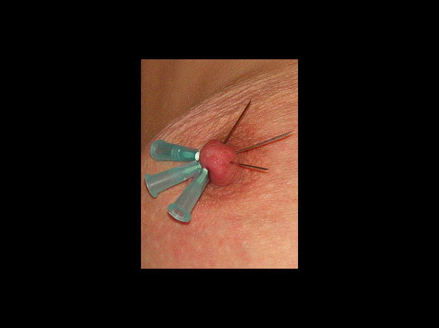 Aiguilles dans les seins (4)