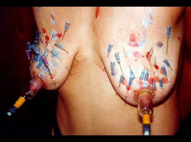 Aiguilles dans les seins (67)