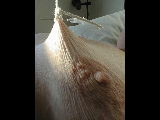 Aiguilles dans les seins (93)