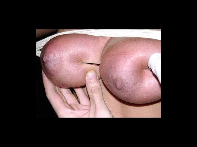 Travail des seins5 (189)