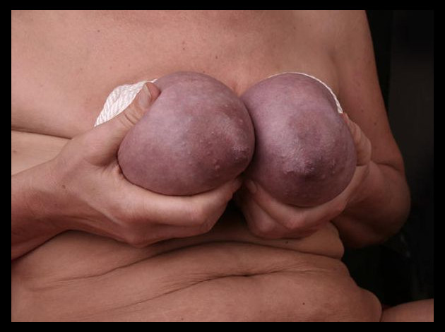 Travail des seins5 (206)