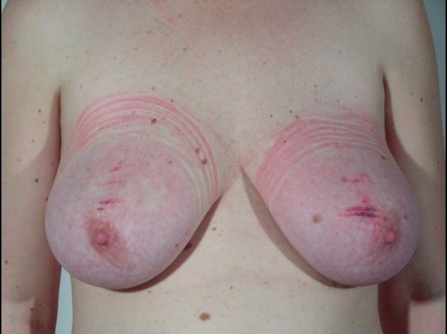 Travail des seins7 (57)