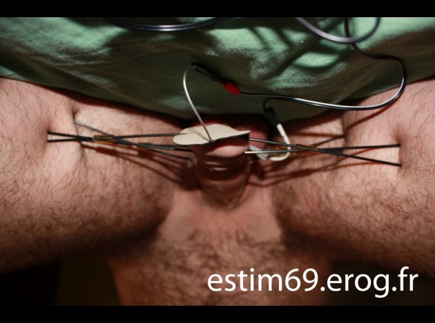e-stim5