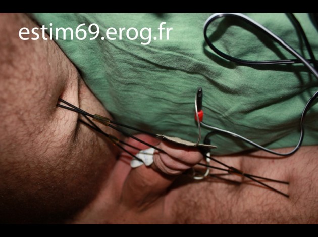 e-stim6