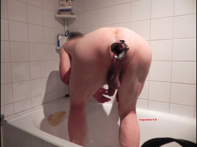 speculum