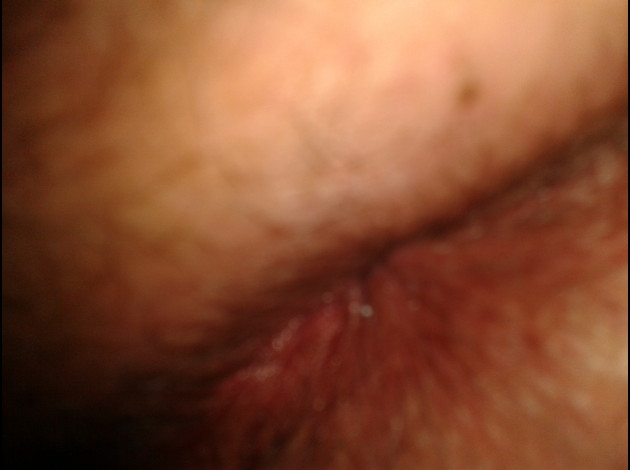 zerda 026