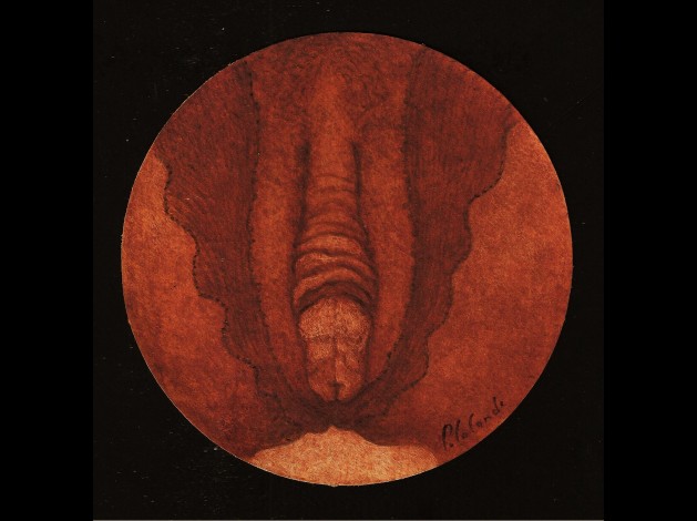 hermaphrodite
