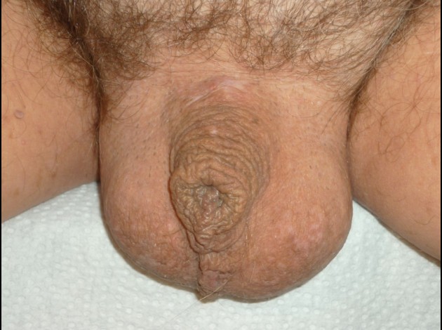 Erog (21)