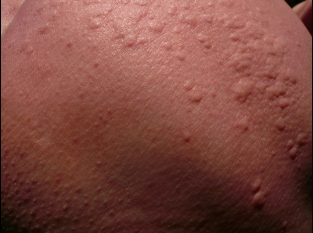 P1210457