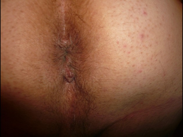 P1200707