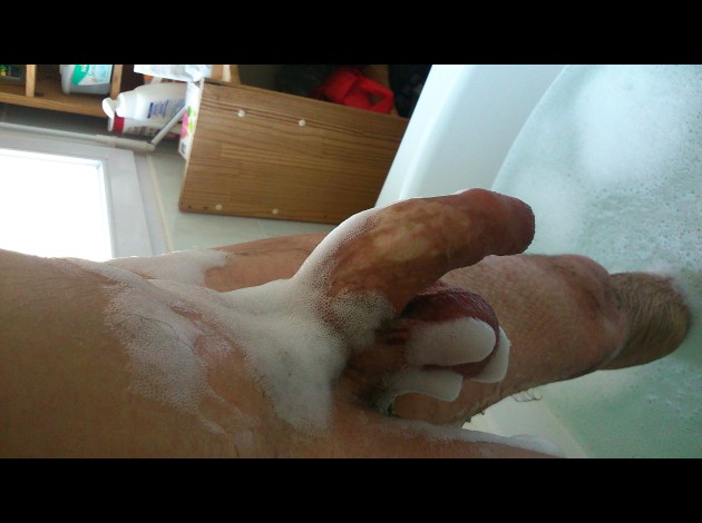 epilation (7)