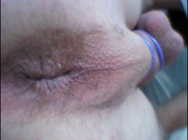 fesse 0432