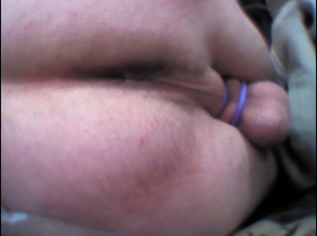 fesse 0440