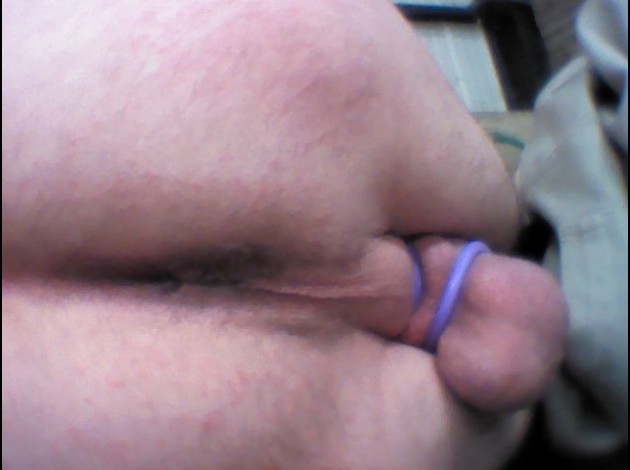 fesse 0441