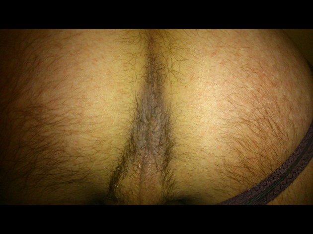 fesse 0461