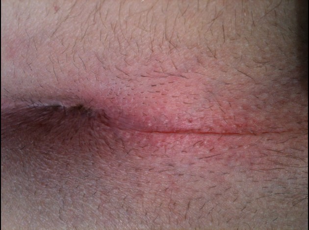 photo (18)