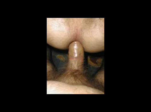 Ma bite