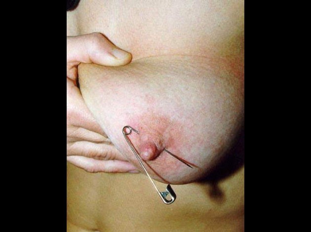 Aiguilles dans les seins (112)