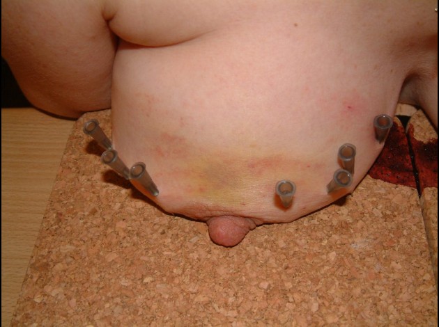 Aiguilles dans les seins (89)