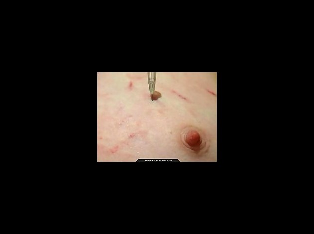 Aiguilles dans les seins1 (167)