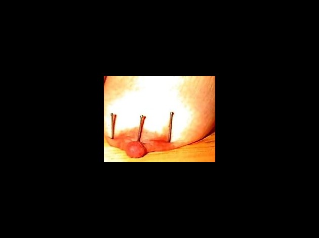 Aiguilles dans les seins1 (30)