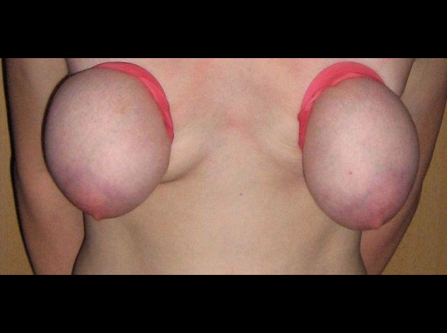 Jeu de seins3 (166)