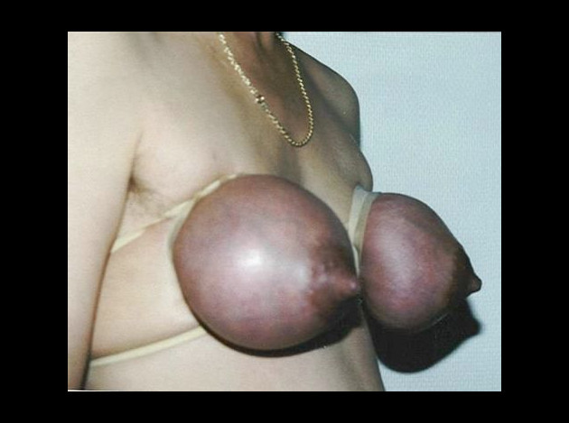 Travail des seins5 (379)