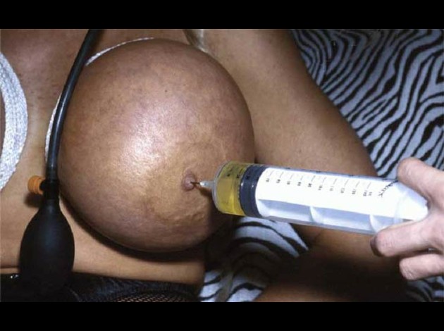 Travail des seins8 (85)