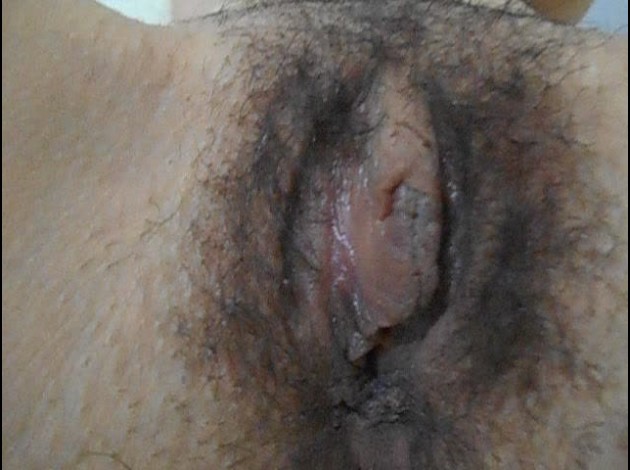 dscg00779