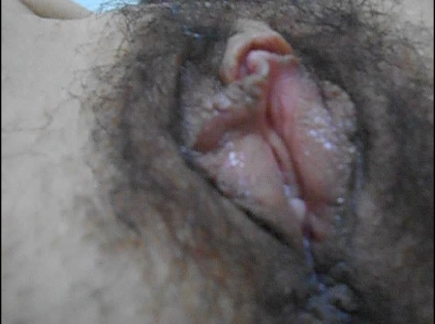 dscg00799