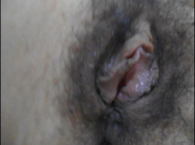 dscg00809