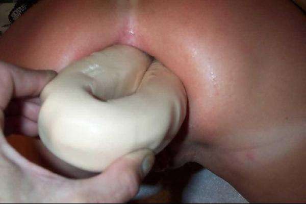 001-anal-extrem-gape.jpg