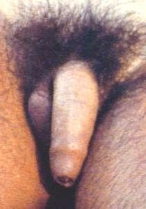 clefts.jpg