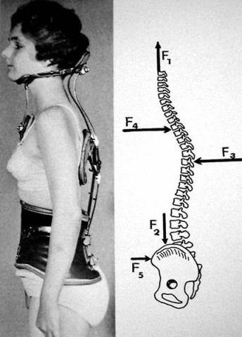 torse_cou_kyphsqueezer.jpg