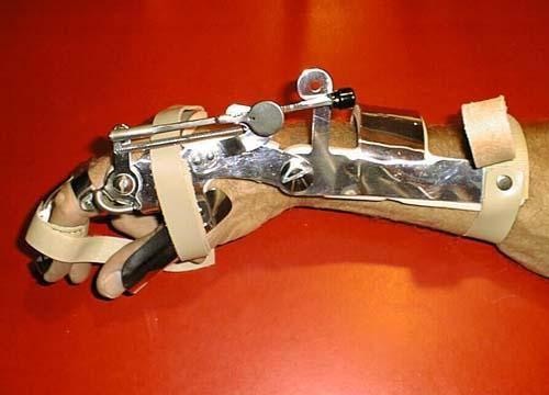hand_brace.jpg