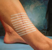 3m-steristrip.jpg