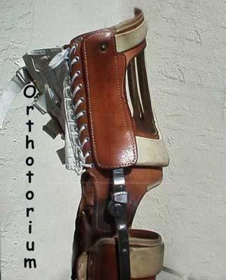 d_taillegbrace.jpg