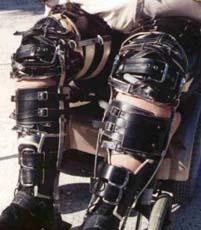 legbraceblack1.jpg