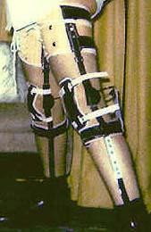 legbraceman.jpg
