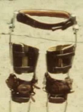 legbracewaist.jpg