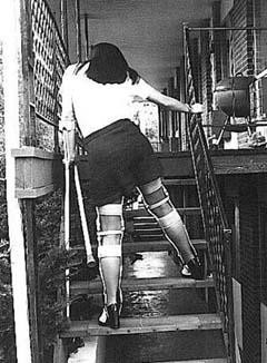 legbracewoman1.jpg