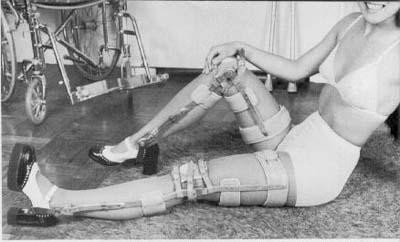 legbracewoman3.jpg