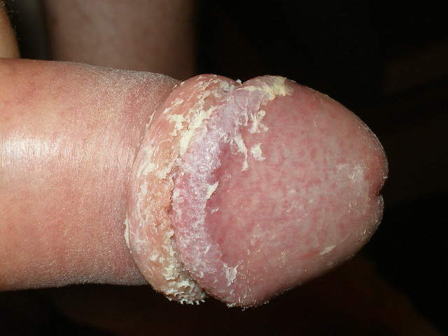 belpied03.jpg